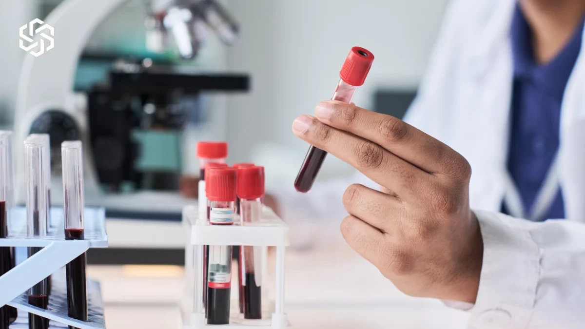 Lab technician holding a blood sample for testosterone therapy lab monitoring